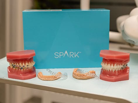 Tipuri de aparate dentare Cluj - Comparatie aparat metalic, ceramic si alignere invizibile Spark
