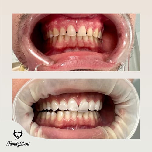 fatete dentare cluj, stomatologie cluj