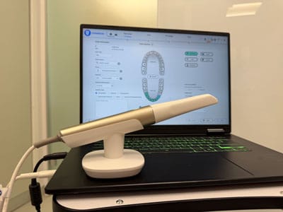 Scanare intraorală digitală 3D pentru implant dentar și proteză fixă pe implanturi la Family Dent Cluj