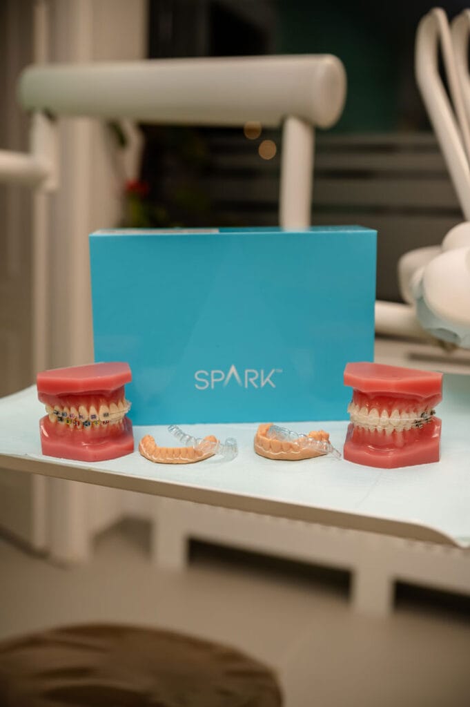 Aparat dentar safir vs ceramic în Cluj, tratament ortodontic estetic la Family Dent